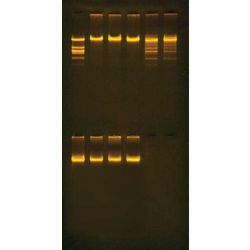 Purification of the Restriction Enzyme Eco Ri Kit