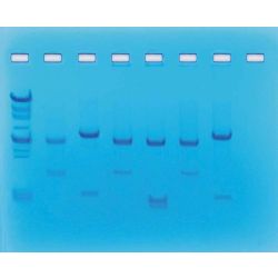 Edvotek® DNA Fingerprinting Using Restriction Enzymes Kit