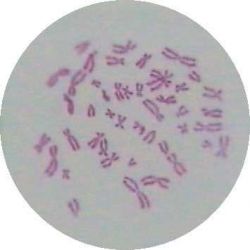 Prepared Slide, Chromosomes Normal Female